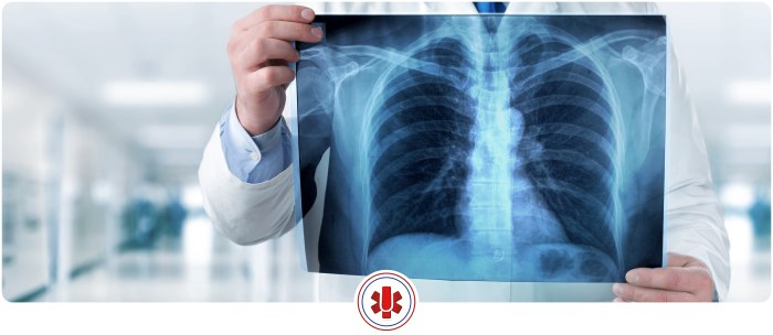 Where To Get an X-Ray Near Me in Horizon City, TX and on North Zaragoza Rd. in El Paso TX, and Lee Trevino Dr. in El Paso TX Where To Get an X-Ray Near Me in Horizon City, TX and on North Zaragoza Rd. in El Paso TX, and Lee Trevino Dr. in El Paso TX