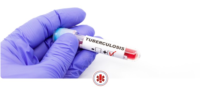 How Much Does a Tuberculosis (TB) Test Cost Near Me In El Paso and Horizon City TX? How Much Does a Tuberculosis (TB) Test Cost Near Me In El Paso and Horizon City TX?